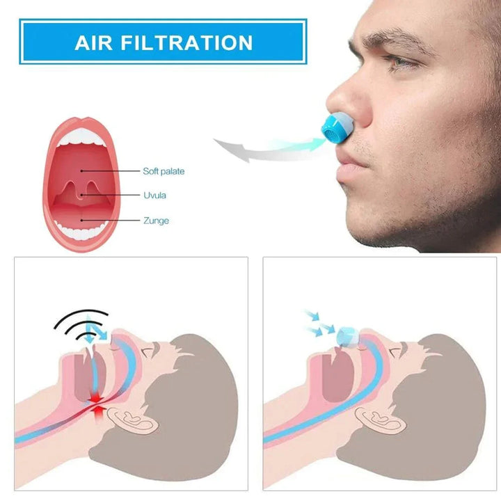 Urządzenie Airing Micro-CPAP dla bezproblemowej ulgi w chrapaniu