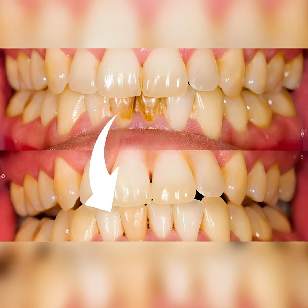 Profesjonalny Skaler Dentystyczny
