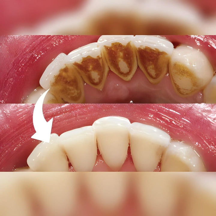 Profesjonalny Skaler Dentystyczny